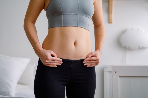 Vientre con cicatriz de cesárea Una mujer en ropa deportiva que demuestra un cuerpo imperfecto después de un parto