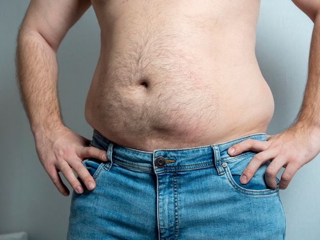 El vientre desnudo de un gordo en jeans. El concepto de problemas con el exceso de peso.