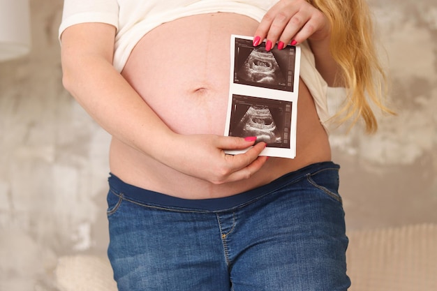 Foto el vientre de una mujer embarazada una mujer embarazada irreconocible sostiene una foto de ultrasonido con su bebé en primer plano enfoque selectivo concepto de embarazo y maternidad