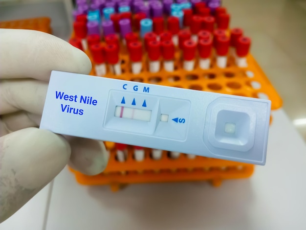 Vírus do Nilo Ocidental ou teste de diagnóstico rápido WNV em laboratório