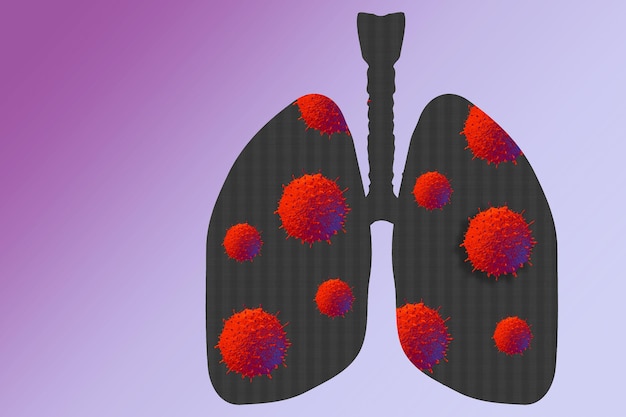 Virus de la enfermedad del coronavirus en los pulmones humanos. Nuevo brote de coronavirus COVID-19