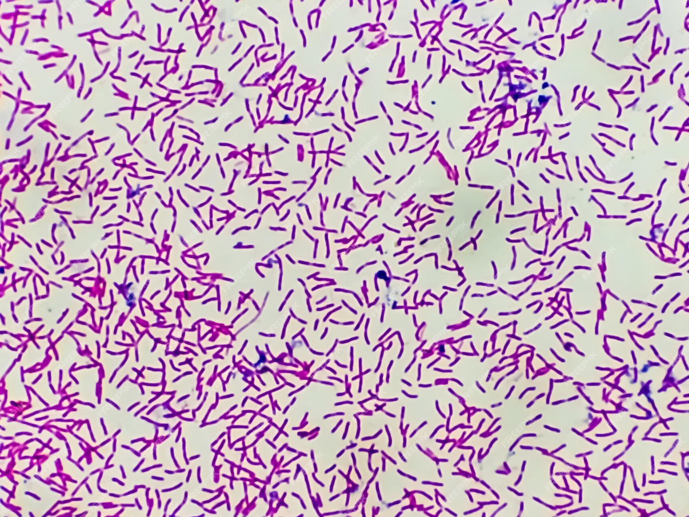 vis-o-microsc-pica-da-colora-o-de-gram-mostrando-a-forma-de-bastonete