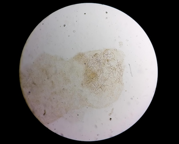 Foto visão microscópica de raspagem de pele para teste de fungos mostrando dermatófitos