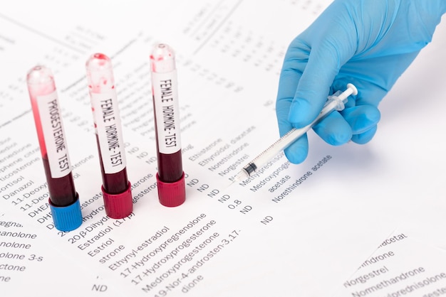Foto visão recortada do médico segurando seringa perto de tubos de ensaio com amostras de sangue e listas com hormônios