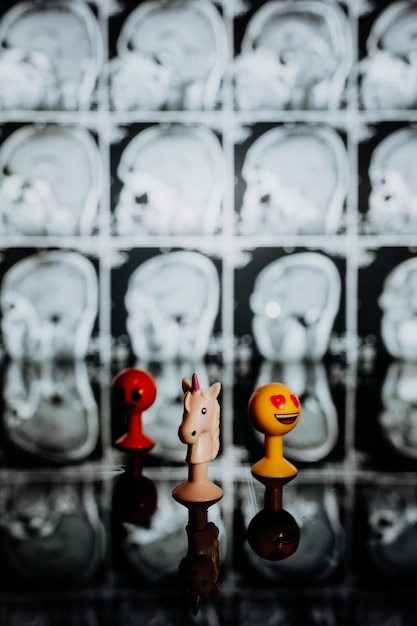 Foto vista de ángulo alto de la estatuilla sobre rayos x médicos