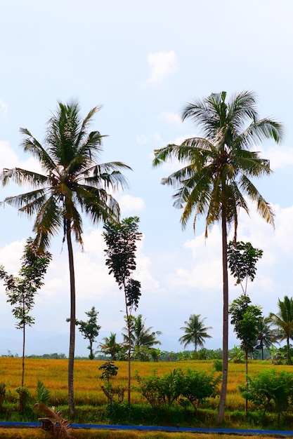 Una vista de un campo con palmeras en primer plano