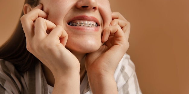 Foto vista de cerca aparatos ortopédicos adolescente muestra los dientes en fondo de estudio de color beige