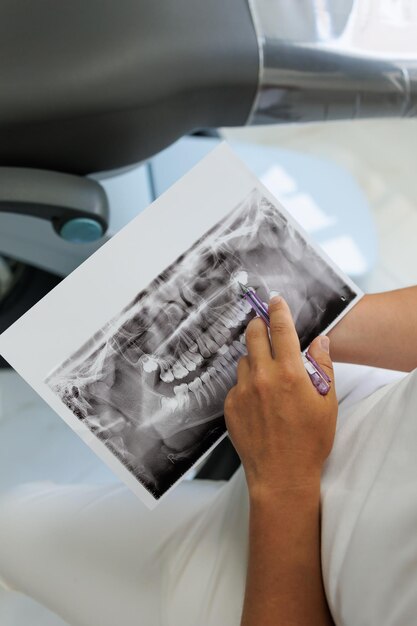 Foto vista de cerca de un médico dentista masculino sosteniendo y mirando una imagen panorámica de rayos x dentales