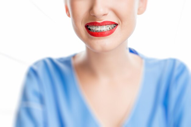 Vista de cerca de la sonrisa de la mujer con frenos dentales en el fondo blanco