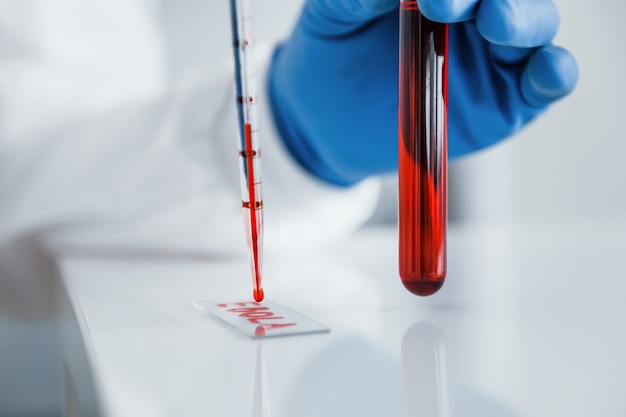 Vista cercana del médico en bata de laboratorio que funciona con un tubo de ensayo con sangre dentro