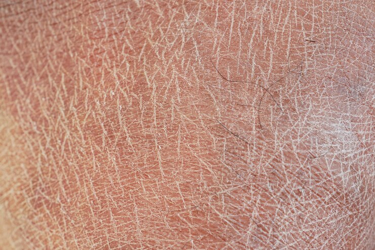 Foto vista de perto da pele humana seca