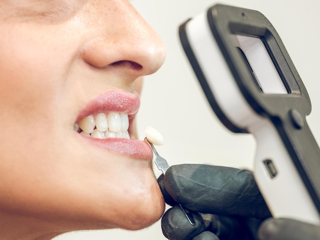 Vista lateral de un estomatólogo irreconocible y sin rostro con lupa e implante en las manos comprobando el tono de los dientes de un paciente anónimo