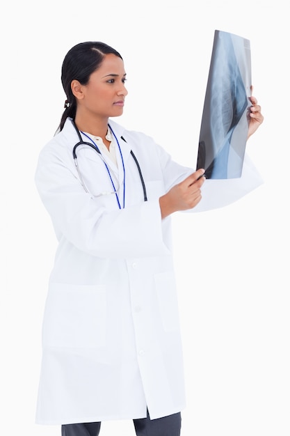 Vista lateral del médico femenino que controla la radiografía