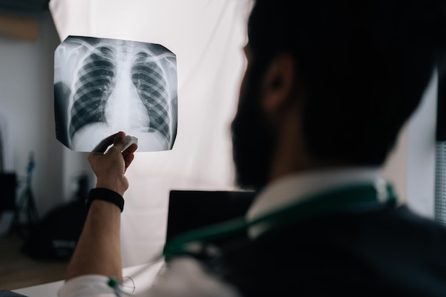 Vista posterior de primer plano de un médico varón irreconocible que examina la exploración de los pulmones de la película de rayos X del tórax del paciente en el departamento de radiología del hospital sentado en el escritorio con una computadora portátil