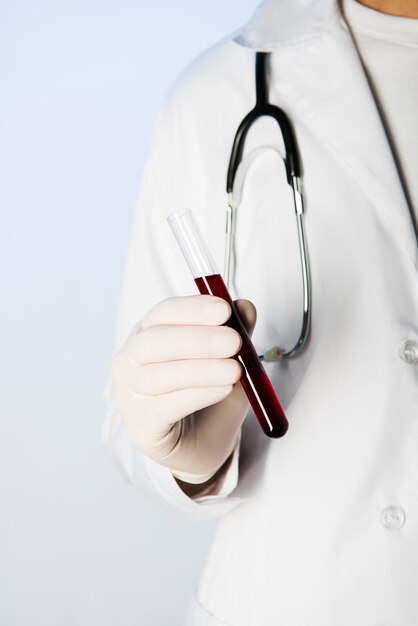 Vista recortada del médico con estetoscopio sosteniendo tubo de ensayo con sangre