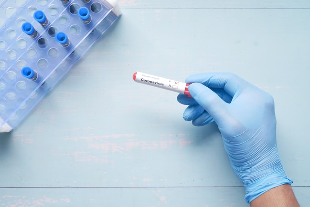 Vista superior da mão com luvas médicas azuis segurando um tubo de análise de sangue na mesa