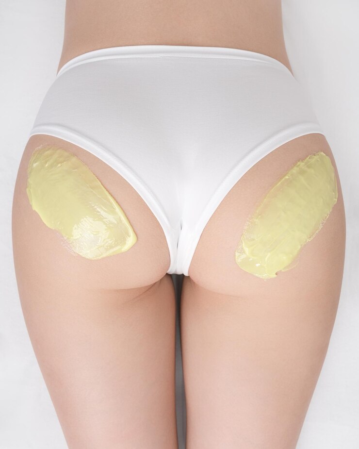 Vista superior de cera quente verde nas nádegas de uma mulher magra enquanto ela está deitada no sofá Processo de depilação