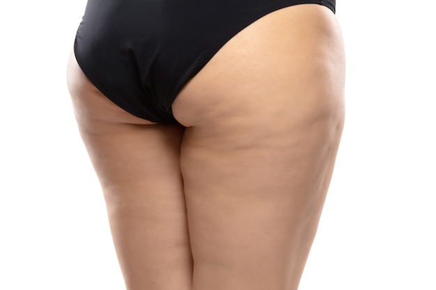 Vista trasera. Mujer con sobrepeso con celulitis grasa piernas y glúteos, obesidad cuerpo femenino en ropa interior negra aislada sobre fondo blanco. Piel de naranja, liposucción, tratamientos sanitarios y de belleza.