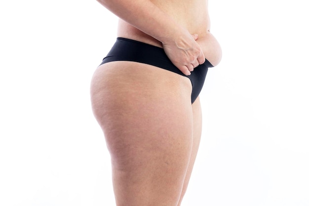 Weiblicher Körper in schwarzen Shorts mit Übergewicht und Cellulite hält Bauchfett Nahaufnahme isoliert auf weißem Hintergrund Seitenansicht
