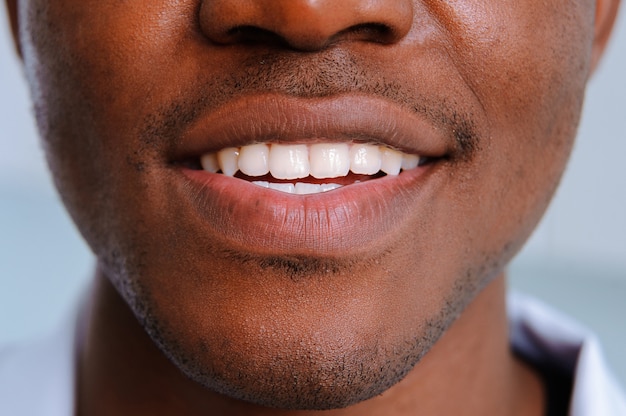 Weiße Zähne lächeln schwarzen Mann hautnah
