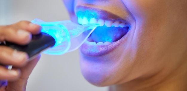 Zähneweißung LED-Werkzeug und Mund der Person Klinik und Behandlung im Büro des Zahnarztes und Nahaufnahme Mundgesundheit Reinigung und Ausrüstung mit Licht für Zahngesundheit und Zahn für Bleichung