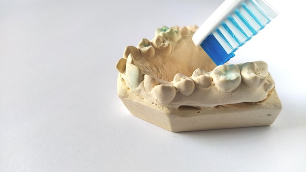 Zahnbürste und Mock menschlichen Kiefer Plaster Unterkiefer Dental- und Gesundheitskonzept Weißer Hintergrund Leuchtend gelbe und blaue Farbe Robuste schiefe Zähne Hilfe des Zahnarztes und Kieferorthopäden