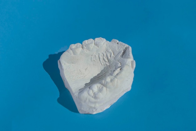 Zahnguss Gipsmodell Gipsabguss stomatologischer menschlicher Kiefer prothetische Laboraufnahmen
