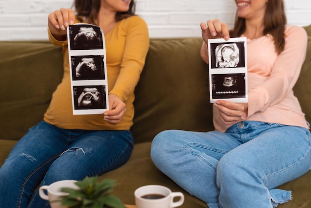 Zwei Frauen sitzen zusammen und halten Ultraschall-Nahaufnahme