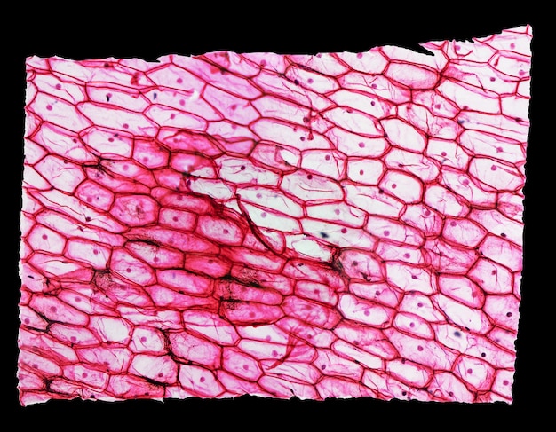 Zwiebel-Epidermus-Mikrographie