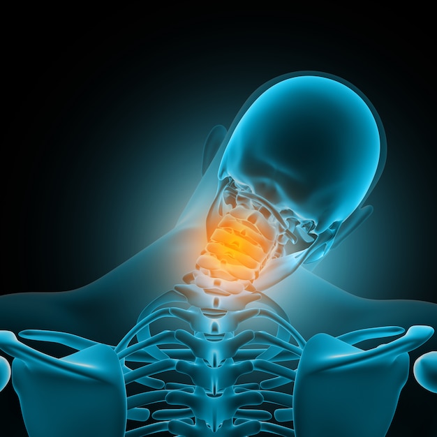 3D male medical figure with neck bones highlighted in pain