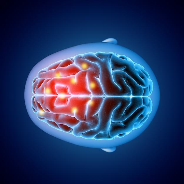 3D medical image showing top view of a brain with parts highlighted