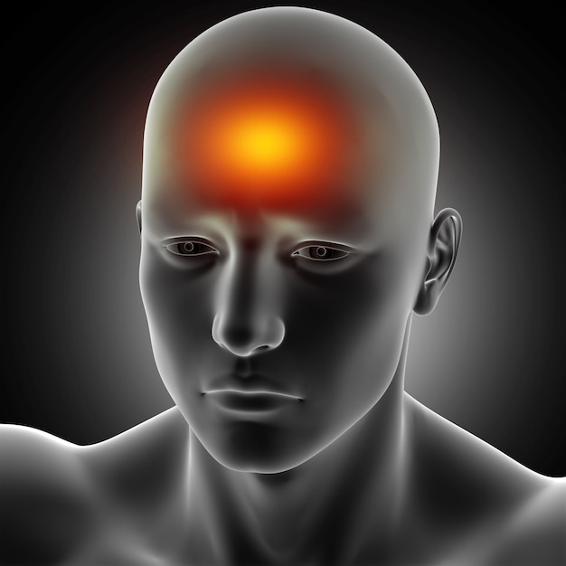 3D render of a male medical figure with headache