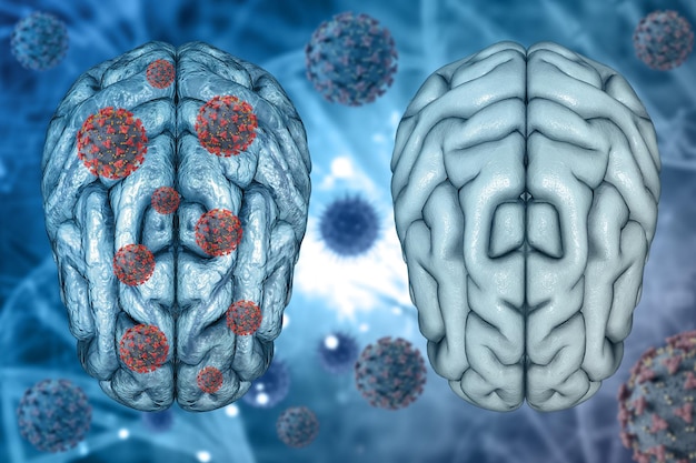 3D render of a medical background of healthy brain and diseased brain with Covid 19 virus cells