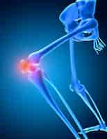 Free photo 3d render of a medical image of a skeleton with knee bone highlighted