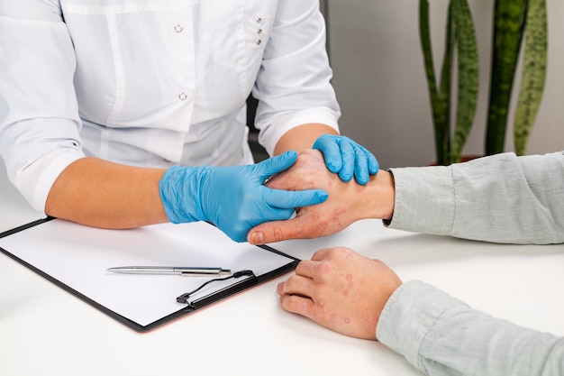 Дерматолог в перчатках осматривает кожу больного пациента. обследование и диагностика кожных заболеваний-аллергия, псориаз, экзема, дерматит.