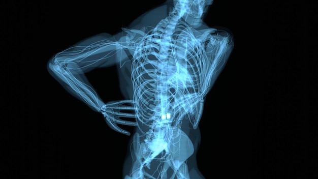 Абстрактный трехмерный дизайн боли в спине