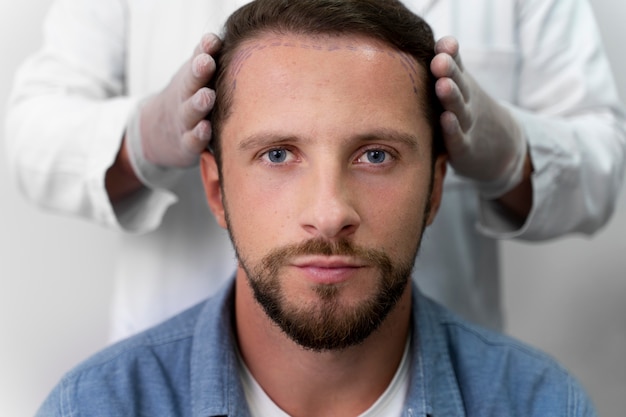 Free photo adult male doing a follicular unit extraction