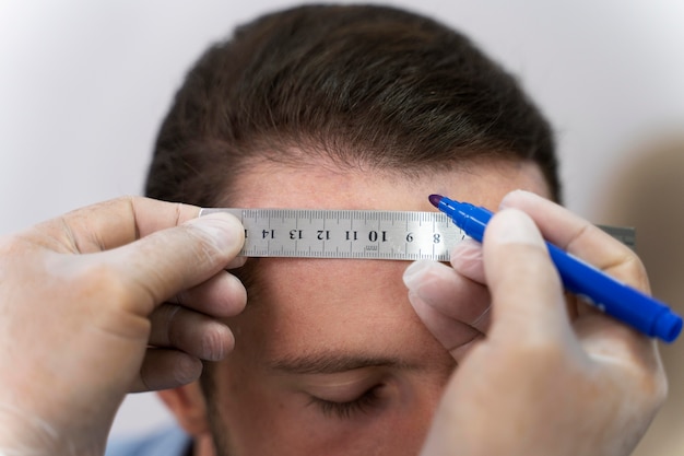 Free photo adult male doing a follicular unit extraction