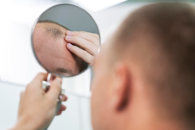 Free photo adult male having balding problems