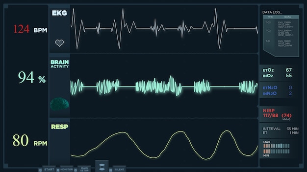 Animation of a fast electrocardiogram reading display. The heartbeats are getting more intense