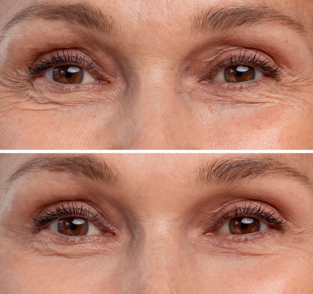 antiaging beauty treatment