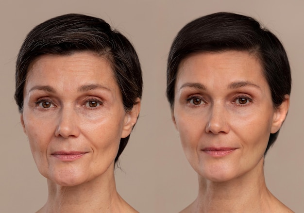 antiaging beauty treatment