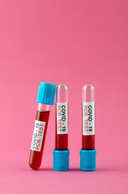 Arrangement with pcr covid19 tests