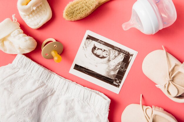 Baby clothing; socks; brush; pacifier; pair of shoes; milk bottle and ultrasound picture on peach background