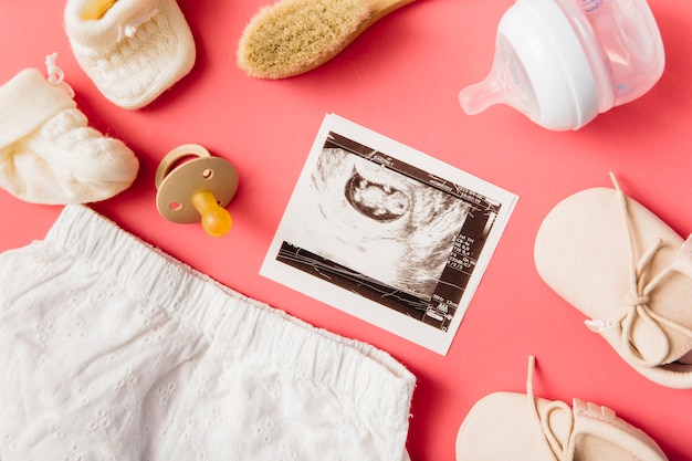 Baby clothing; socks; brush; pacifier; pair of shoes; milk bottle and ultrasound picture on peach background