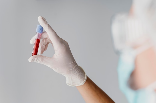 Free photo back view doctor holding a blood sample