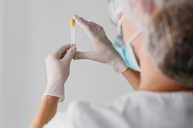 Free photo back view doctor holding a blood sample