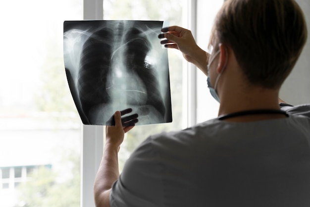 Back view of doctor looking at radiography