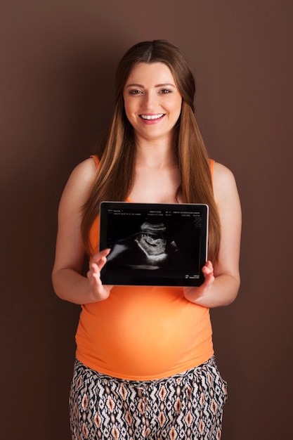 無料写真 デジタルタブレットで超音波スキャンを示す美しい妊婦