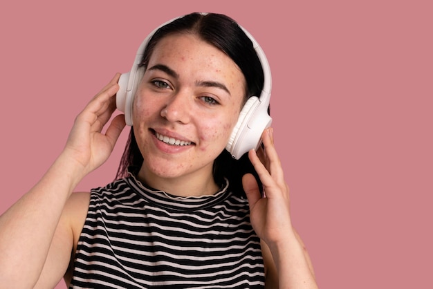 Beautiful young woman with acne listening to music